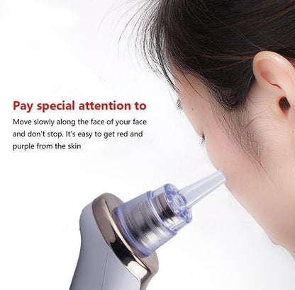 Blackhead Electric Suction Facial Cleaner, Beauty Instrument for Acne Removal and Blackhead Cleaning.