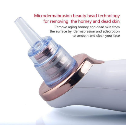 Blackhead Electric Suction Facial Cleaner, Beauty Instrument for Acne Removal and Blackhead Cleaning.