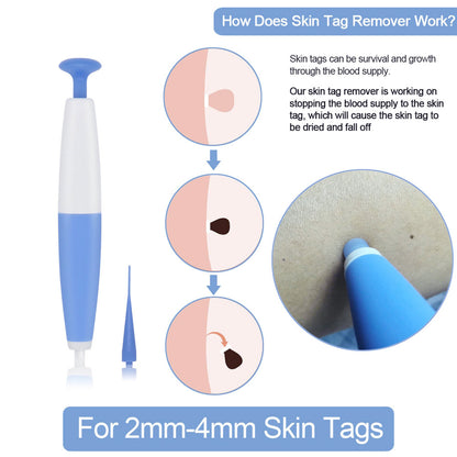 Skin Tag Removal Kit Home Use Mole Wart Remover Micro Band Skin Tag Treatment Tool Easy to Clean Skin Care Tool